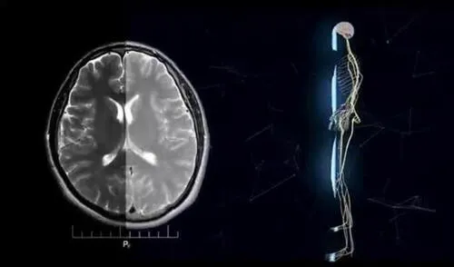 La idea de utilizar robots diminutos en el campo de la medicina está abandonando el umbral de la ficción a causa de múltiples iniciativas. Foto: captura de EFE