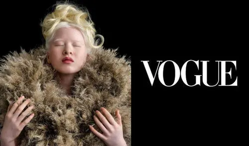 La condición de Xueli no ha significado un obstáculo, sino un impulso para adentrarse en el mundo del modelaje. Foto: composición Facebook/Instagram La condición de Xueli no ha significado un obstáculo, sino un impulso para adentrarse en el mundo del modelaje. Foto: composición Facebook/Instagram