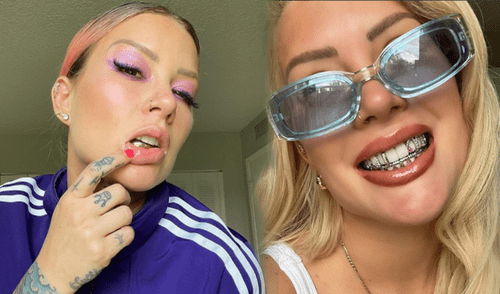 Los implantes de diamantes de Leslie Shaw fueron un regalo de un reconocido joyero que trabaja con J Balvin. Foto: Leslie Shaw/Instagram