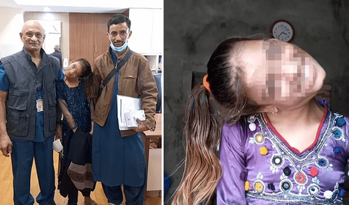 Afsheen Gul vivió prácticamente toda su vida con el cuello en 90 grados. Foto: Instagram/Afsheen Gul Afsheen Gul vivió prácticamente toda su vida con el cuello en 90 grados. Foto: Instagram/Afsheen Gul