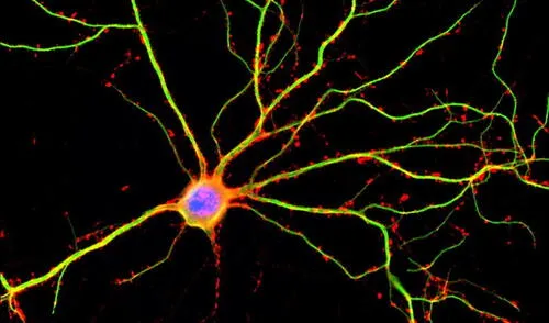 El párkinson es una enfermedad neurodegenerativa que todavía no goza de un tratamiento eficaz. Foto: Shelley Halpain / UC San Diego
