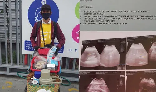 Debido a su condición, la madre de familia solo debe guardar reposo hasta su operación. Foto: composicion/ La República