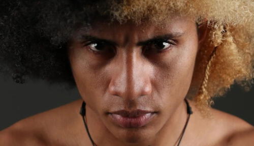 El concursante "Tarzán" está acaparando la atención de los seguidores de "Desafío" por la lesión que padeció. Foto: Quénoticias