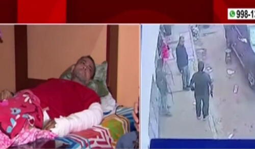 La bala está alojada en sus glúteos. Foto: captura América Noticias La bala está alojada en sus glúteos. Foto: captura América Noticias