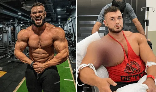 Ryan es fisicoculturista desde los 16 años y cuenta que nunca ha experimentado un dolor así. Foto: composición LR/Instagram: @ryancrowley97