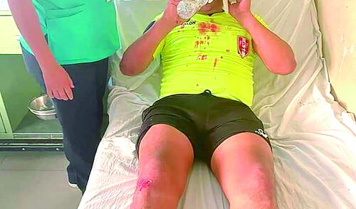 VIOLENCIA. La Copa Perú se tiño de sangre en Cusco, un árbitro fue agredido y podría perder la vista. En Arequipa hubo pelea.