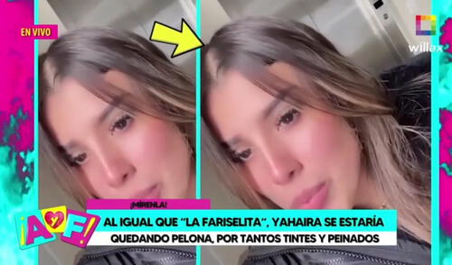 ¿Una enfermedad o mucho uso de productos capilares? Yahaira Plasencia muestra señales de pérdida de cabello, según "Amor y fuego". Foto: Willax TV