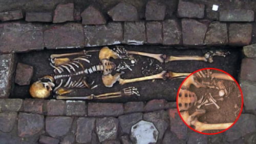 Los restos tenían un orificio en el cráneo. Foto: composición LR/ World Neurosurgery Misterio de una mujer embarazada