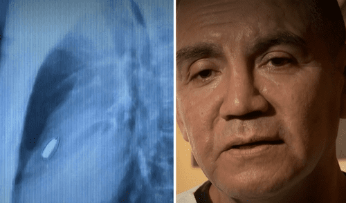 El taxista no puede pagar los miles de soles que le pide la clínica Ricardo Palma. Foto: composición LR/captura de Latina La Victoria