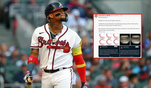 Ronald Acuña Jr. se perdió el Round Robin de la LVBP 2023-24 con Tiburones de La Guaira.