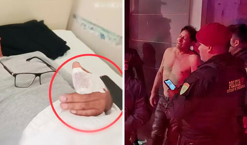 Hombre muerde y cercena el dedo de sereno en Trujillo