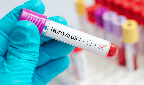 Norovirus | Estados Unidos