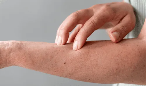 Científicos australianos revelan que en los brazos humanos se desarrolla un arteria media que suele desaparecer durante el desarrollo fetal