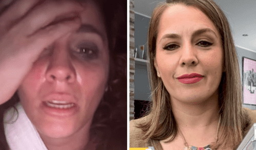 Yiddá Eslava revela en Instagram que sufrió un accidente en el set de filmación