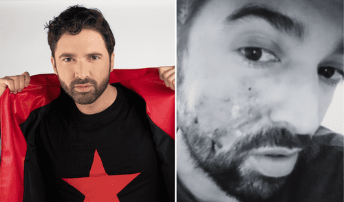 Carlos Girón Longoria fue atacado por un perro en la cara. Foto: Composición LR/Carlos Girón Longoria/Instagram Carlos Girón Longoria es un conocido actor de 'Como dice el dicho'.