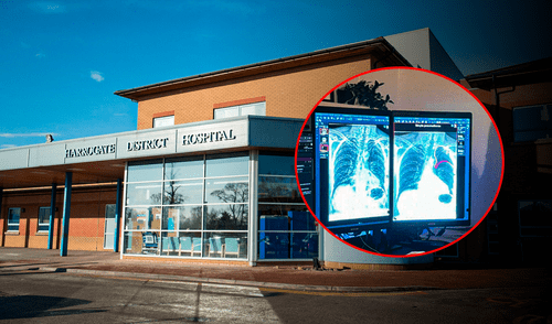 Financiado por el Fondo de Diagnósticos de IA del NHS, se espera reducir errores humanos y mejorar la eficiencia operativa en radiología. Foto: composición LR/Harrogate and District NHS Foundation Trust. Hospital en Inglaterra usa IA para detectar cáncer y otras anomalías en segundos: hasta 124 hallazgos en menos de un minuto