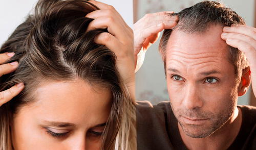 "Las personas suelen perder de 50 a 100 hebras de cabello al día", dijo Mayo Clinic. Foto: Composición LR/Clinica de Tratamiento Capilar/Primor