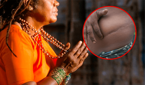 La mujer logró convencer a su esposo para realizarse la cirugía, pero durante su recuperación huyó con el dinero. Foto: composición LR / X / AFP venta de organos | india | infidelidad | engaño | trampa | hombre vende sus organos | mujer huye con dinero