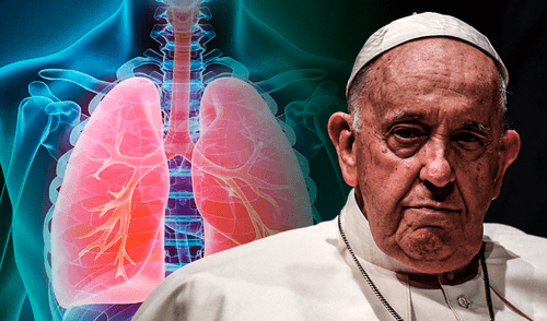 Broncoespasmo, la afección que agravó el cuadro clínico del papa Francisco