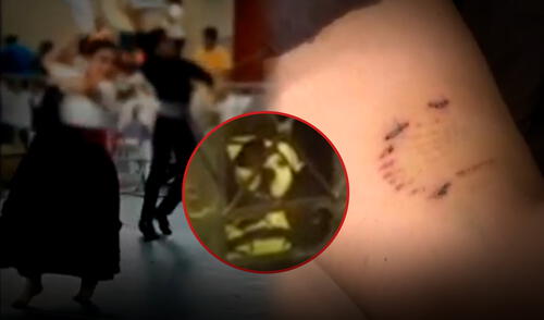 La madre de la menor asegura que su hija no puede moverse luego del ataque del perro. Foto: Composición LR La madre de la menor asegura que su hija no puede moverse luego del ataque del perro. Foto: Composición LR