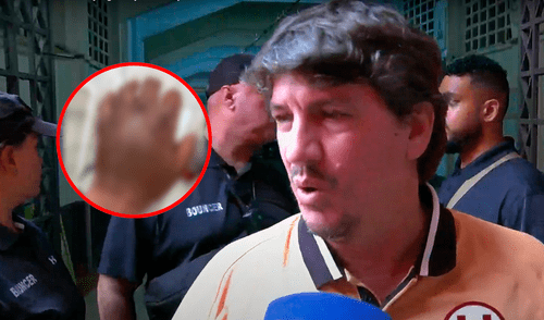 Jean Ferrari revela cómo quedó la mano de Ureña tras el triunfo de Universitario