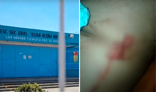 La agresión tuvo lugar en las afueras de la escuela Elisa Acuña Rosetti, el pasado 4 de marzo.