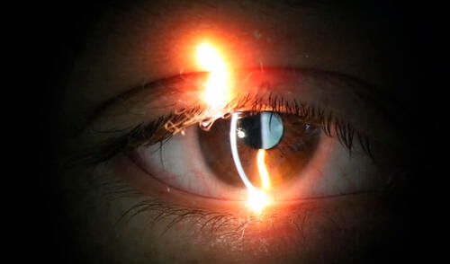 Canadá albergará la primera clínica especializada en un innovador tratamiento que ha logrado restaurar la visión en ciertos casos de ceguera, con una tasa de éxito del 94%.