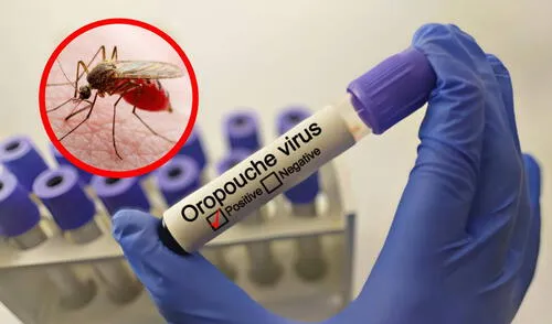 ¿Qué es el virus Oropouche, la nueva fiebre detectada en 5 casos diferentes por Minsalud en Venezuela?
