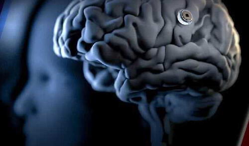 Científicos plantean dispositivo digital para tratar enfermedades cerebrales