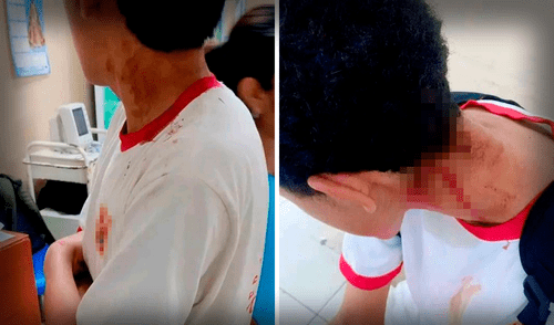 Una madre de familia denuncio que su hijo fue atacado presuntamente con un arma blanca. Foto: composición LR/difusión Escolares se enfrentaron en Chincha