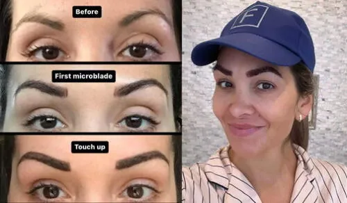 Marchand tomó la decisión de dejar las depilaciones constantes por un trasplante de cejas valorado en US$5.500. Foto: composición LR.