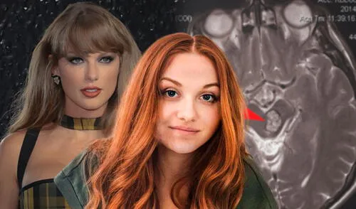 Joven fanática de Taylor Swift sufrió negligencia médica en Carolina del Norte. Foto: Composición LR/AFP/Cavernoma Alliance UK/Facebook Joven fanática de Taylor Swift sufrió negligencia médica en Carolina del Norte. Foto: Composición LR/AFP/Cavernoma Alliance UK/Facebook