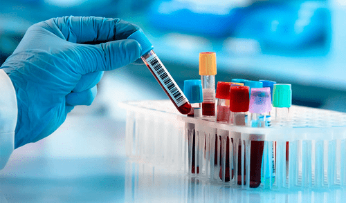 Un estudio en 50 mil personas revela que un tipo de sangre presenta mayor disposición a las enfermedades cardiacas.