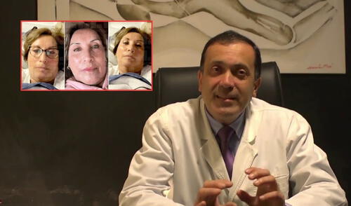 Mario Cabani reveló detalles sobre las operaciones estéticas a las que se sometió la presidenta Dina Boluarte