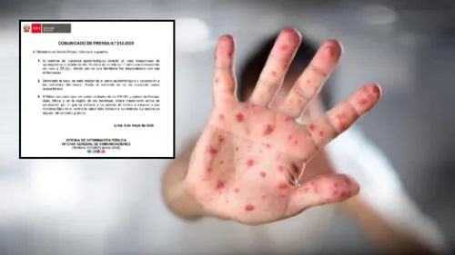 Minsa pide a padres vacunar a sus menores hijos.