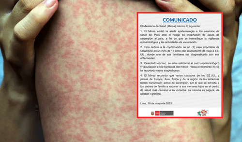Alerta epidemiológica Ministerio de Salud. Foto: composición La República/ Minsa