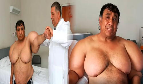 Alejandro Ramos aún tiene la esperanza de regresar al mar a pesar de su enfermedad. Foto: Composición LR/ BBC Mundo El buzo peruano que lleva 11 años 'inflado' contó cómo sucedió su trágico accidente: su caso sigue siendo un misterio médico