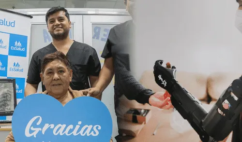 Adulta mayor podrá realizar movimientos funcionales tras operación de EsSalud. Foto: composición de Jazmin Ceras/La República/Gob Adulta mayor podrá realizar movimientos funcionales tras operación de EsSalud. Foto