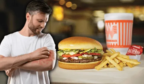 Texano demanda a Whataburger por reacción alérgica a cebolla.