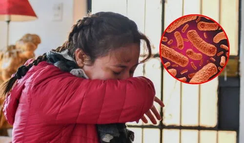 Brote de tosferina en Perú con más de 600 casos confirmados. Brote de tosferina en Perú con más de 600 casos confirmados.