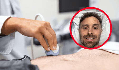 La enfermedad de Crohn, que padecía desde hace años, pudo ser un factor desencadenante del tumor.