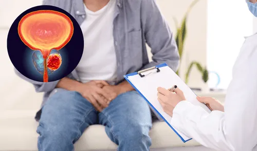 El cáncer de próstata afecta a 313.780 hombres en el mundo. Foto: Composición LR El cáncer de próstata afecta a 313.780 hombres en el mundo. Foto: Composición LR