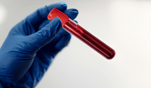 La sangre artificial japonesa se prueba en humanos por primera vez en 2025.