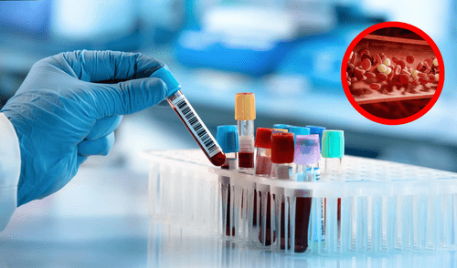 Científicos identifican grupo sanguíneo nunca antes visto tras 15 años de estudio.