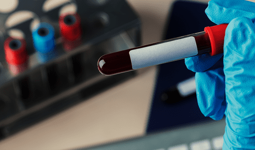 Gwada negativo, Francia