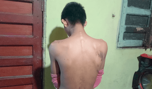 Soldado denunció que fue golpeado y que fue denunciado por dos de sus superiores. Foto: Difusión Soldado denunció que fue golpeado y que fue denunciado por dos de sus superiores. Foto: Difusión