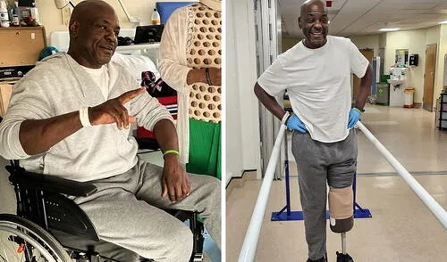 Un hombre en Londres se hizo la pedicura y terminó perdiendo la pierna: tenía una enfermedad degenerativa