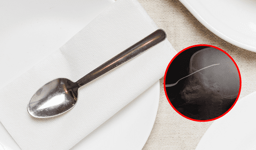 Niña resulta gravemente herida tras incrustarse una cuchara en el ojo izquierdo. Foto: Composición LR/@CronicaPolicial Venezuela, accidentes en casa