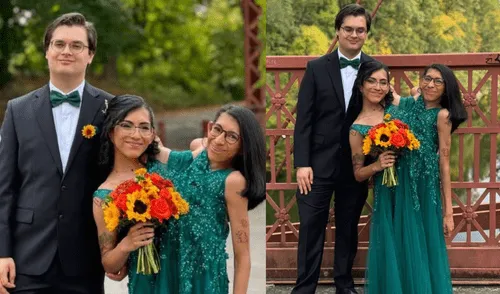 Carmen Andrade, siamesa mexicana, se casó con su novio en EEUU tras cinco años de relación