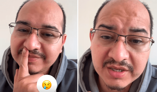 'Pelado' de Todo Good declaró que también presentan problemas con lives en Instagram.